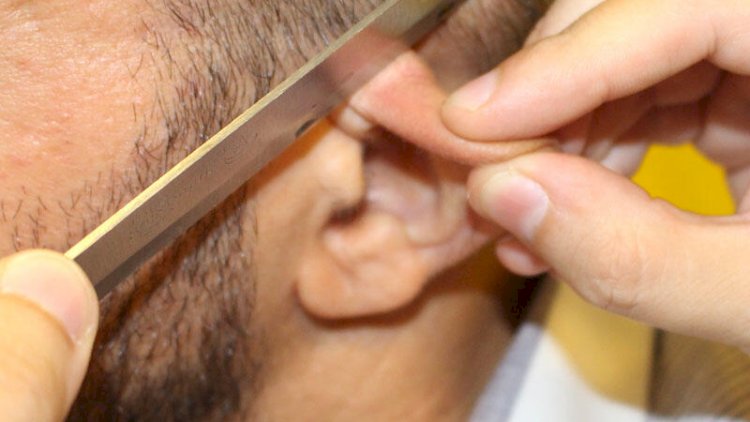   Azərbaycanda 28 yaşlı oğlanın qulağını kəsdilər   