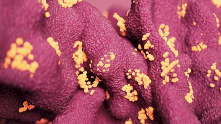    Çində yeni virus tapıldı: Langya gəlir!   