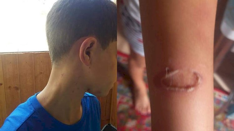   Azərbaycanda dəhşət: Ana övladını döyüb bu hala saldı - Fotolar   