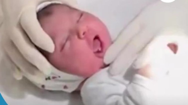    Sumqayıtda iki dişli körpə doğuldu   