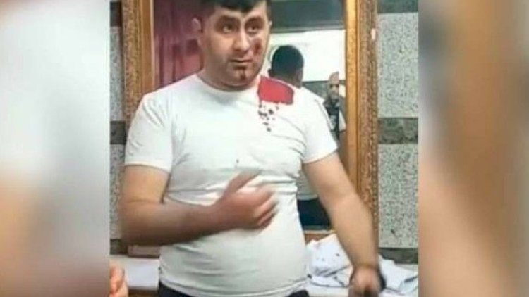    Terrorçunun fikri hamını öldürmək idi, hazırlıqlı gəlmişdi - Vasif Tağıyev   