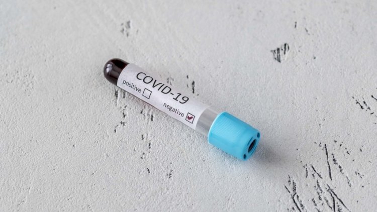    Azərbaycanda COVID:   1 nəfər öldü