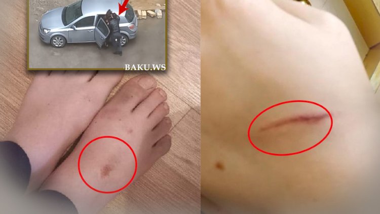    Küçədə qaçırılan qadınla bağlı şok detallar - FOTO   