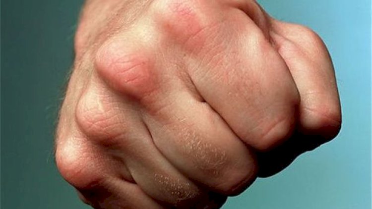    Abşeronda kişi deyingən arvadını yumruqladı: Bu cəzanı aldı   