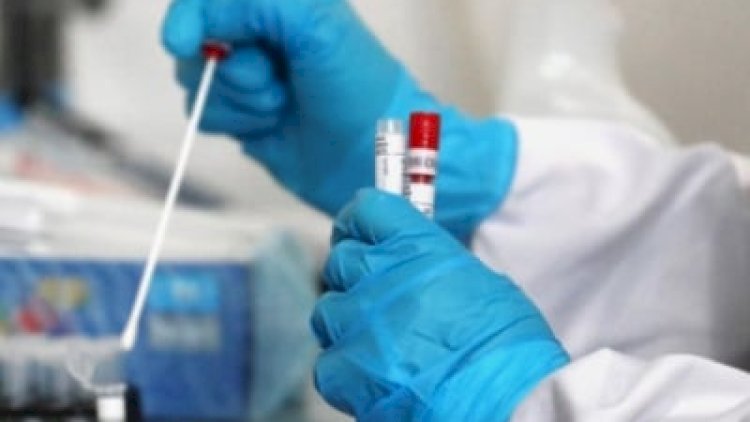    COVID-19-a aid kəşfiyyat məlumatları açıqlanacaq   