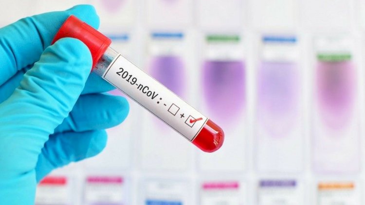    Azərbaycanda COVID: 29 yeni yoluxma   