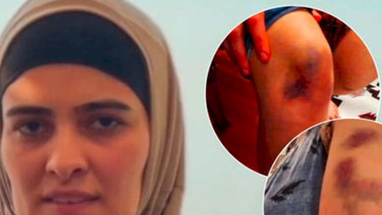    Arvadının başına silah dirəyən polkovnik işdən çıxarıldı   