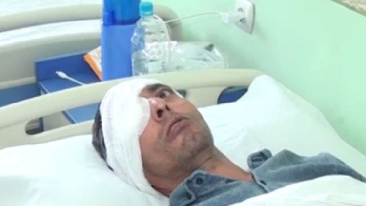    Gəncədə növbə üstündə dava düşdü:   “Gözümün pərdəsini cırıb” - Video