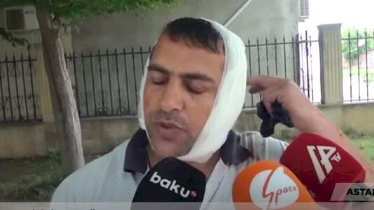   Qulağını eşşək qopardan kişi görün kimdir - VİDEO   