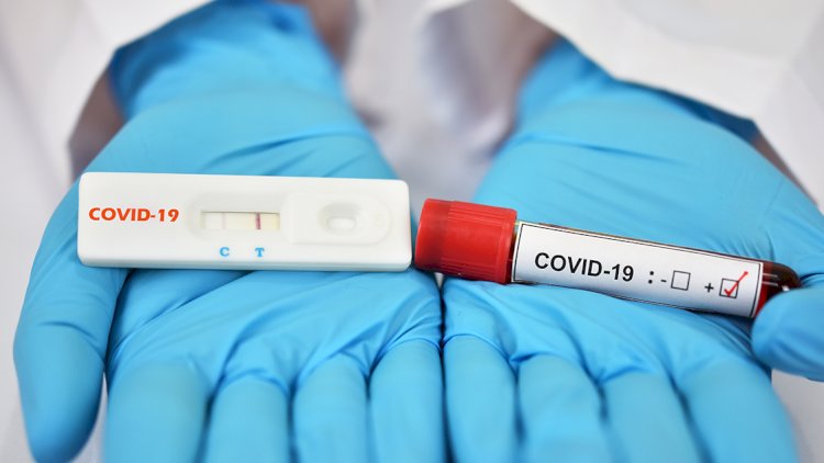    Son gündə 4 nəfər COVID-ə yoluxdu   