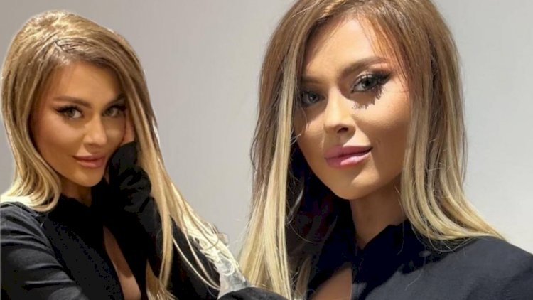    İlqarənin yeni görünüşü təəccübləndirdi - Fotolar   