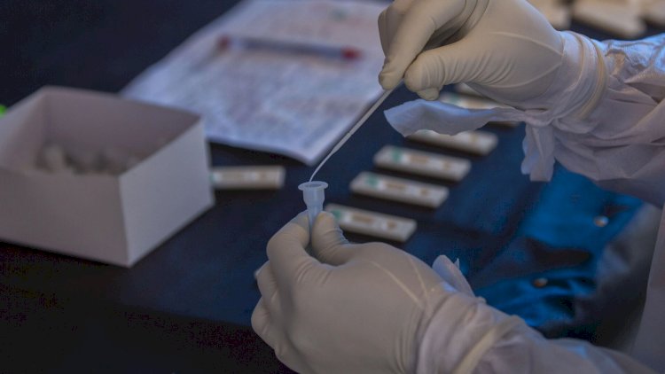    Azərbaycanda koronavirusla bağlı son   VƏZİYYƏT