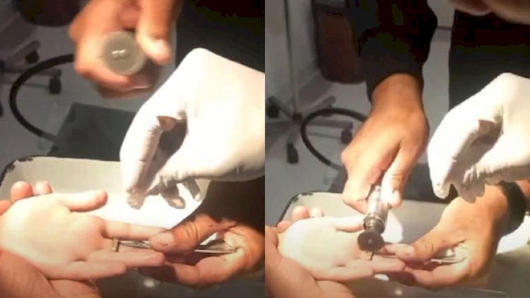    Bakıda azyaşlının barmağında dəmir halqa sıxışdı - Video   