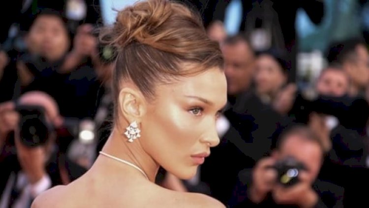    Instagram-da modeli qabırğalarını saydılar   