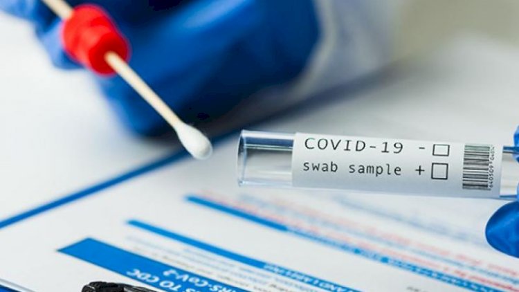    Payızda COVID-ə yoluxanların sayı artacaq?   