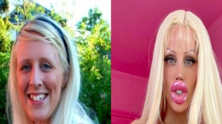    Özünü “Barbi”yə oxşatmaq üçün 130 min dollar xərclədi   