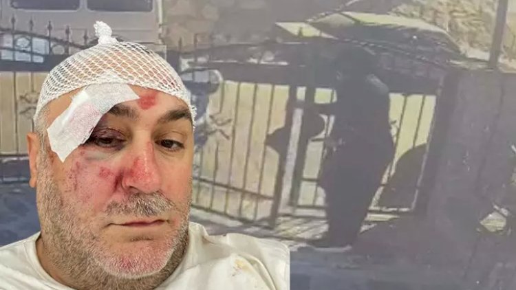    Ofisiant müdirini döyüb 100 minini apardı   - Video