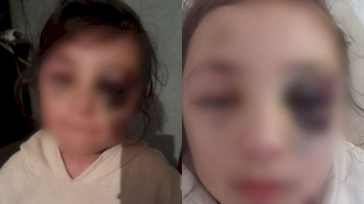    Bakıda şagirdin xəsarət almasına görə müəllimə töhmət verildi   