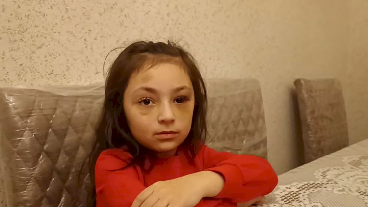    “Direktor maddiyyatla həll etmək istəyirdi” – Döyüldüyü deyilən məktəblinin ANASI   