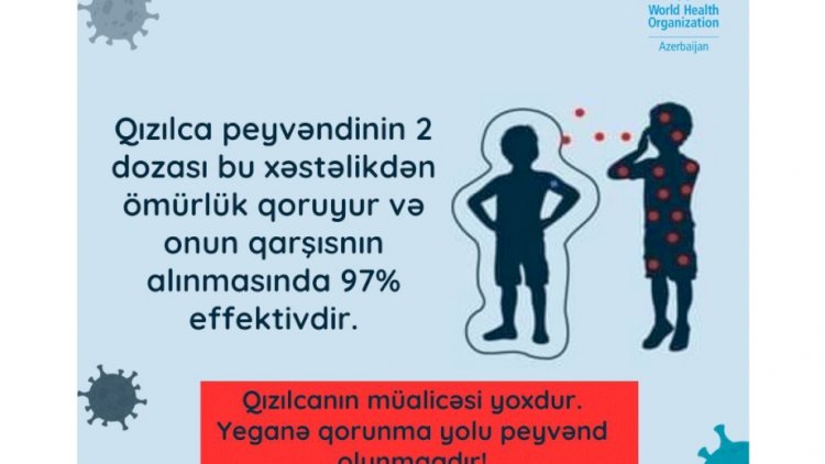    Qızılca 5 yaşdan kiçik uşaqlar üçün daha təhlükəlidir    