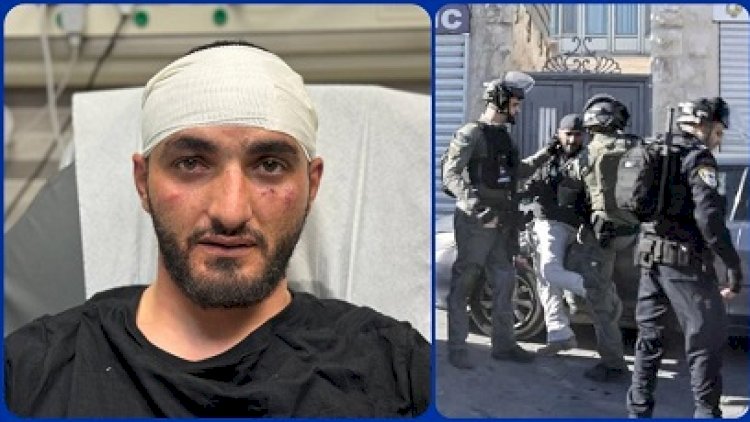    İsrail polisi “Anadolu”nun fotomüxbirini döydü   