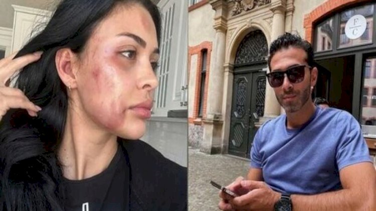    Modeli döyməkdə ittiham olunan şəxsin istintaqı başa çatdı   