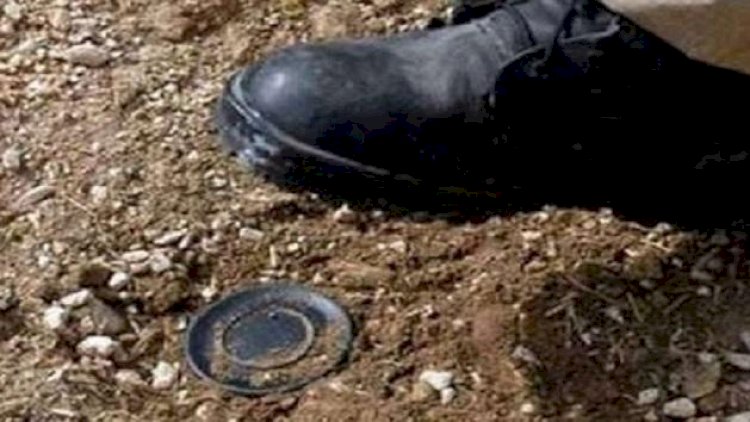    Tərtərdə minaya düşən şəxsin ayağı amputasiya edildi   
