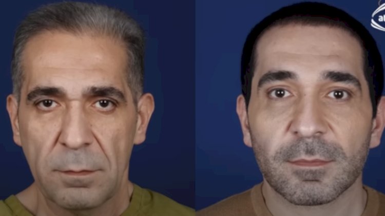    Nurlan Əzizbəyli yeni görünüşü ilə İLK DƏFƏ EFİRDƏ   