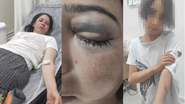    Əri üstünə arvad gətirdi, qardaşı döydü   