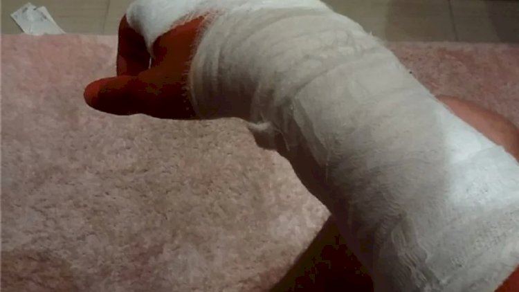   Biləsuvar sakini laqonda ilə barmaqlarını doğradı   