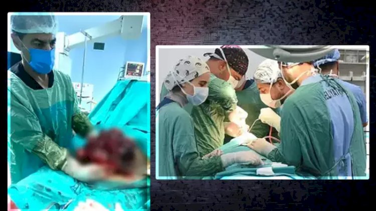    Xəstəxanaya getməsəydi, bilməyəcəkdi: İllərlə bətnində imiş...   - 10 kilo!  