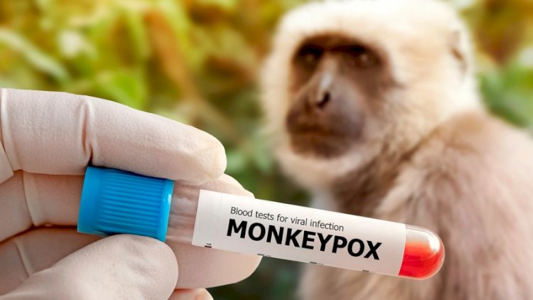    Afrikada meymunçiçəyi epidemiyası sürətlə yayılır   