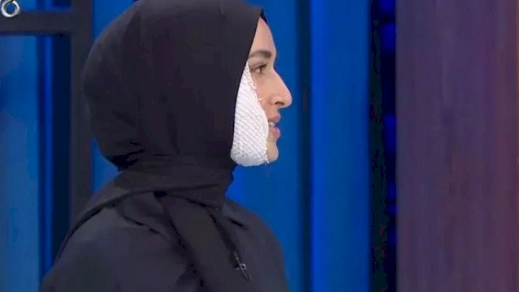    Üzünə qaynar yağ tökülən iştirakçı yarışmaya qayıtdı   