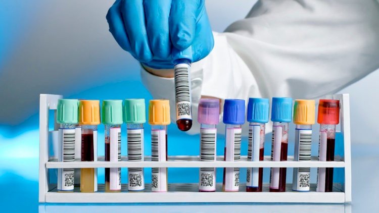    Qadınlar üçün ən vacib hormonal analizlər -   Mütləq yoxladın