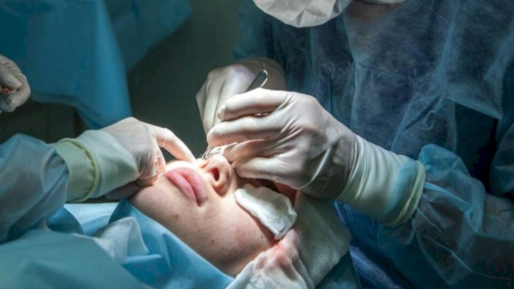    “Plastik cərrahlara saxta sənədlərin verilməsinin səbəbi korrupsiyadır”   