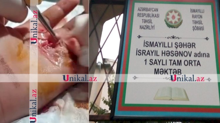    İsmayıllıda şagird sinif yoldaşını yaralayıb - Sinif rəhbəri hadisəni gizlədib   + SƏS YAZISI
