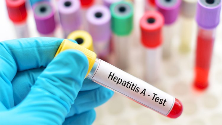    Hepatit A virusu sürətlə yayılır   