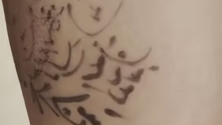    Uşağın xəstə ayağına dua yazdılar - Azərbaycanda biabırçı hadisə   
