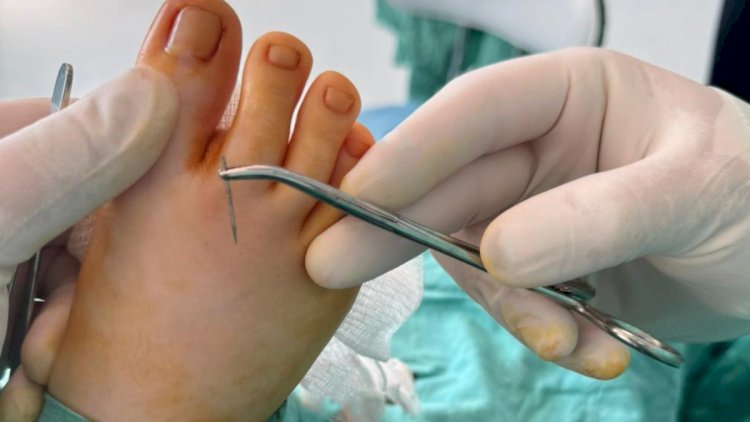    11 yaşlı uşağın ayağında qırılıb qalan iynə 14 gün sonra çıxarıldı - Fotolar   
