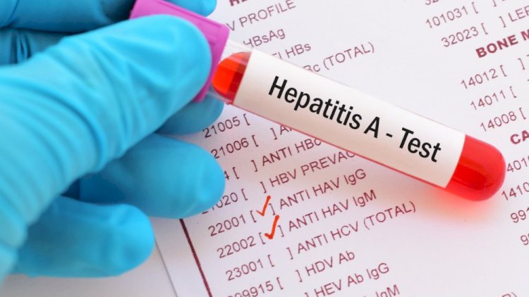    Hepatit A virusu yayılır -   Ölənlər var