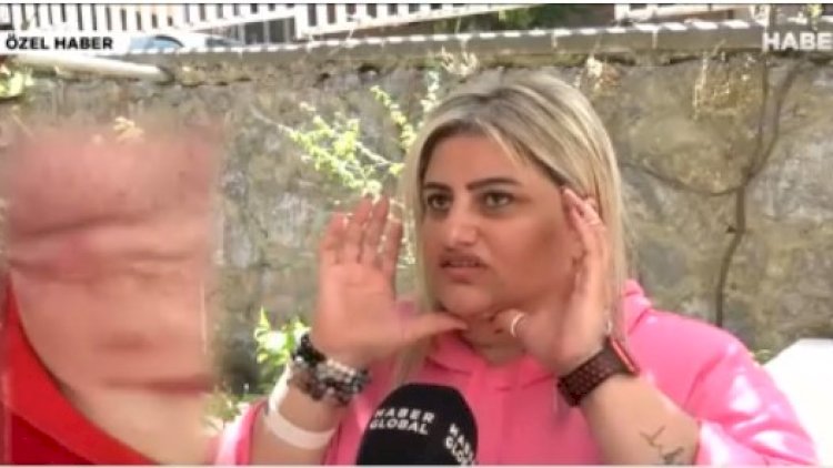    Gözəlləşmək istədi, həyatı kabusa çevrildi   - VİDEO