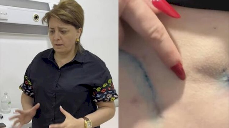    “MedAura” klinikasında saxta estetik cərrah: “Bədənim çürüyür”   