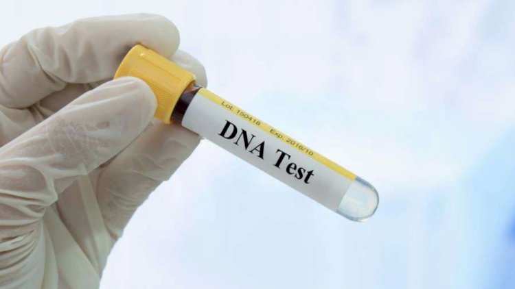    DNT testindən imtina edən atalar,  bu, alimentin məbləğinə birbaşa təsir göstərir   