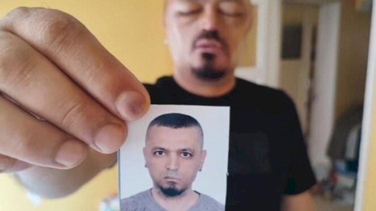    İnternetdən aldığı şampun həyatını kabusa çevirdi - FOTO   