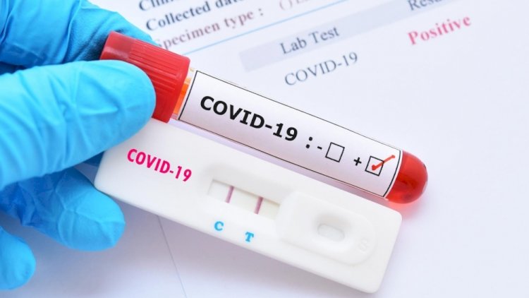    Azərbaycanda koronavirus yenidən gündəmdə -   Son zamanlar ölən olubmu?