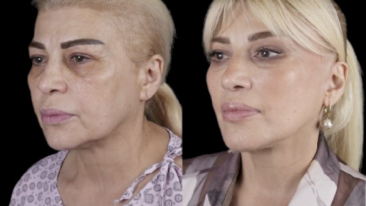    Mətanət İsgəndərli yeni əməliyyatdan sonra - Foto   