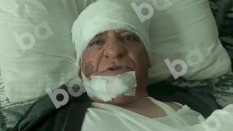    Partlayışda yaralanan şəxs: Məni qan aparırdı - Video   