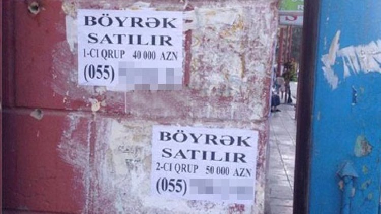    Azərbaycanda şok hadisə:   Böyrəyini satmaq istəyən şəxs 6 min manat cərimələndi