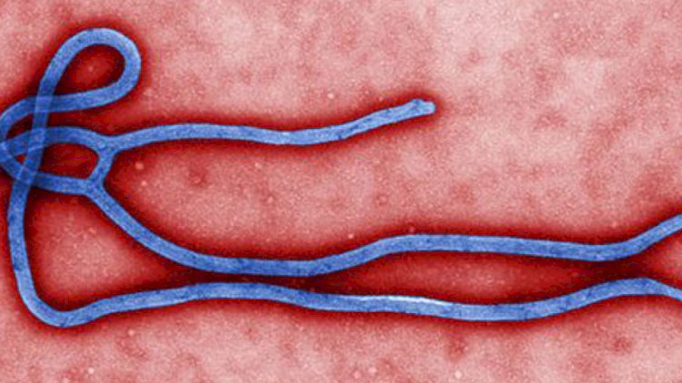    Azərbaycanda Ebola xəstəliyinin yayılması riski varmı?   