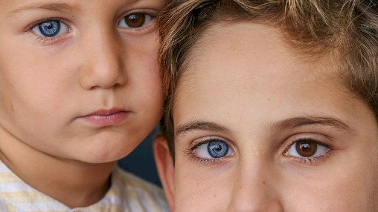    Göz rəngini dəyişmək istəyənlər, bilin: “Bu prosedur geri dönüşsüzdür”   